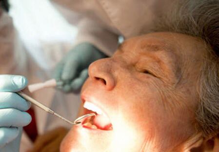 Campanha para detecção do câncer bucal acontece em parceria com a vacinação contra a gripe