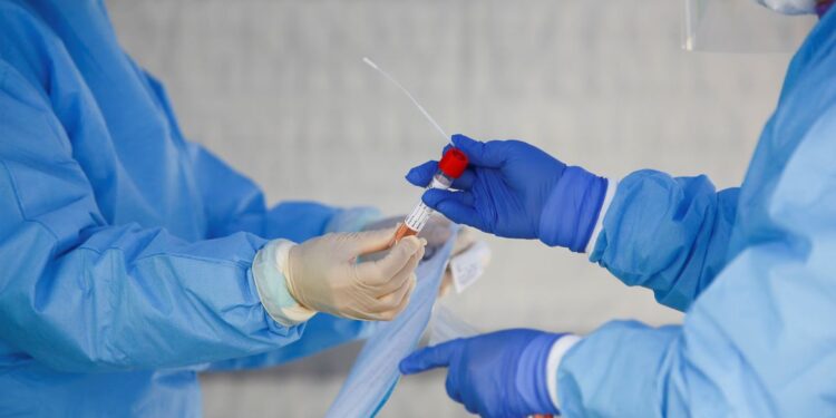 Covid-19: Brasil tem 16,1 milhões de casos e 449,8 mil mortes