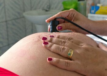 Covid-19: mortalidade de gestantes é mais que o dobro da média no país
