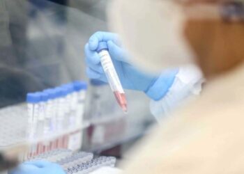 SE registra 180 casos de Covid-19 e mais dois óbitos que estavam em investigação
