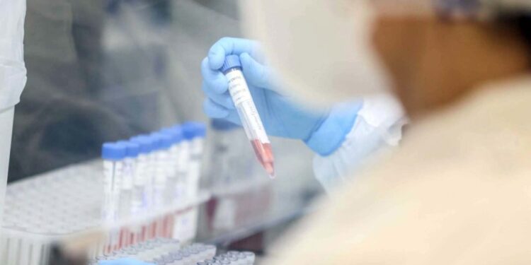 SE registra 180 casos de Covid-19 e mais dois óbitos que estavam em investigação