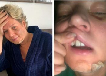 Polícia Civil do DF conclui que Joice Hasselmann sofreu queda e não foi agredida