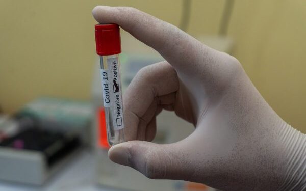 Sergipe registra 33 casos de Covid-19 e mais um óbito nesta terça