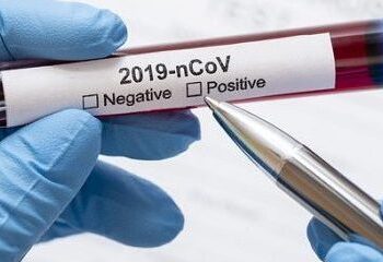 Sergipe tem 30 casos novos de Covid-19 e 1 óbito registado