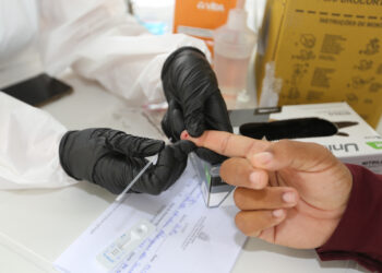 Coronavírus ainda demanda atenção, mesmo com taxa de transmissão baixa