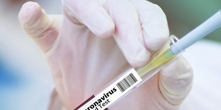 Sergipe mantém estabilidade no número de novos casos nas últimas 24h