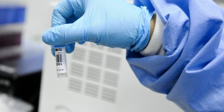 Sergipe tem 17 novos casos de Covid-19 e nenhum óbito foi registrado