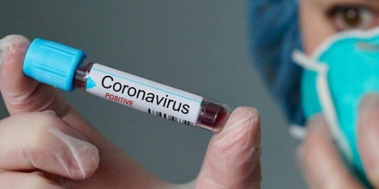 Sergipe registra seis novos casos de Covid-19 e um óbito