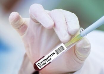 Sergipe registra 14 novos casos de Covid-19 e um óbito
