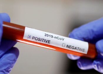 Sergipe registra 10 novos casos de Covid-19 e nenhum óbito