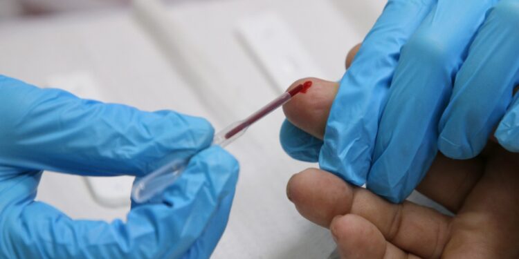 Dezembro vermelho: SES realiza testes rápidos para HIV, Sífilis e Hepatites no centro de Aracaju