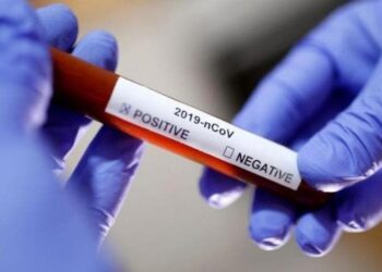 Sergipe registra 465 novos casos de Covid-19 e um óbito nesta quarta