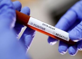 Sergipe registra um óbito por Covid-19 e nenhum caso novo da doença nesta segunda, 03