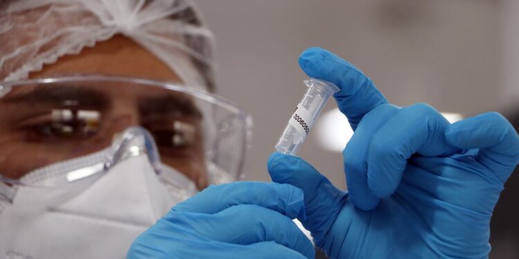 Sergipe registra 97 novos casos de Covid-19 e um óbito nesta segunda, 17