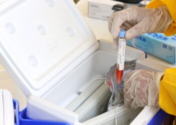 Aracaju orienta sobre atendimento e resultado dos testes de covid-19