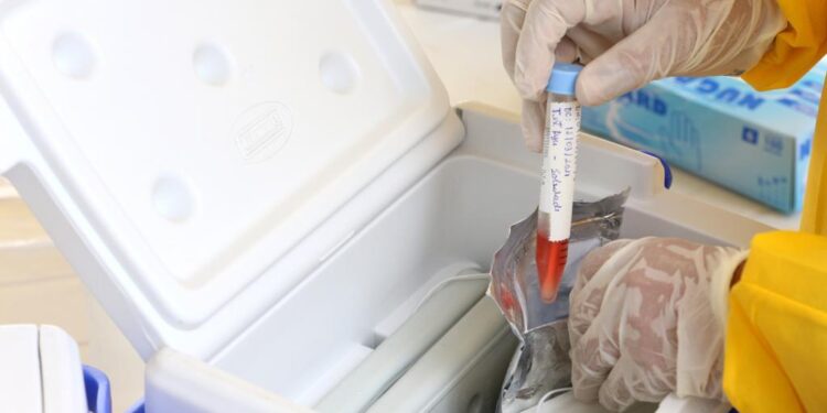 Aracaju orienta sobre atendimento e resultado dos testes de covid-19