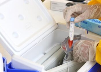 Testagens covid passarão a ser realizadas em 41 UBS de Aracaju