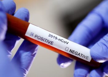 Sergipe registra 182 novos casos de Covid-19 e dois óbitos nesta terça, 22