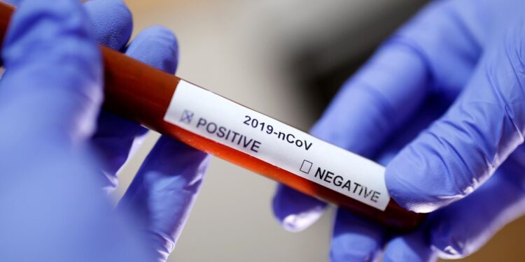 Sergipe registra 182 novos casos de Covid-19 e dois óbitos nesta terça, 22