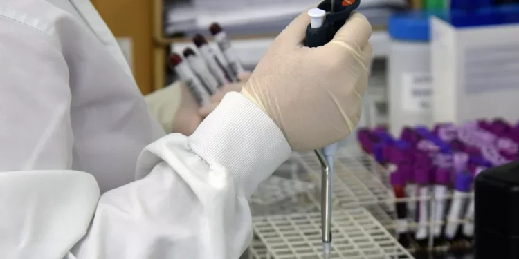 Sergipe registra 202 novos casos de Covid-19 e dois óbitos nesta terça, 15