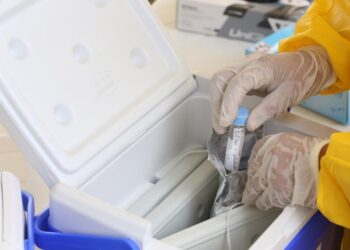 Aracaju mantém testagem para covid em 44 unidades de saúde