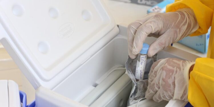 Aracaju mantém testagem para covid em 44 unidades de saúde
