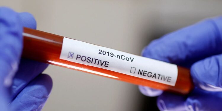 Sergipe registra 10 novos casos de Covid-19 e nenhum óbito neste domingo, 22