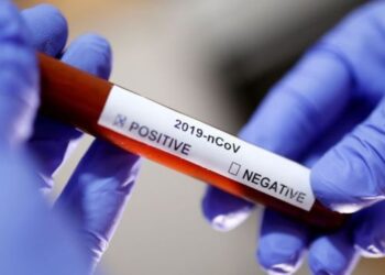 SE registra 253 novos casos de covid-19 e dois óbitos nesta quarta