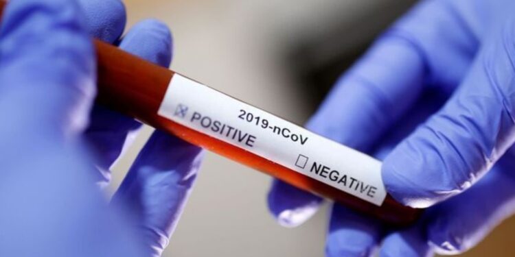 SE registra 253 novos casos de covid-19 e dois óbitos nesta quarta