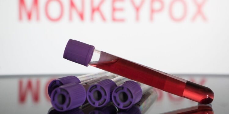 Brasil faz 8.850 testes de varíola dos macacos