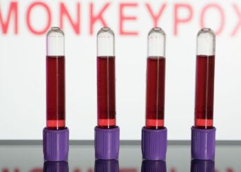 Anvisa autoriza uso emergencial de kits para varíola dos macacos