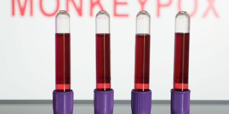 Anvisa autoriza uso emergencial de kits para varíola dos macacos