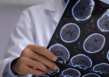 Esclerose múltipla: especialista esclarece mitos e verdades sobre a doença