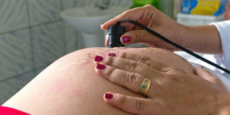 Entidade alerta para risco de diabetes em gestantes