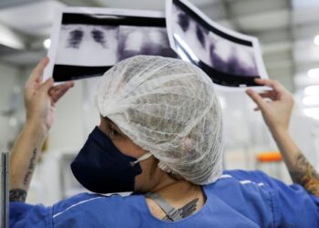 Síndromes respiratórias se aproximam de menor patamar da pandemia