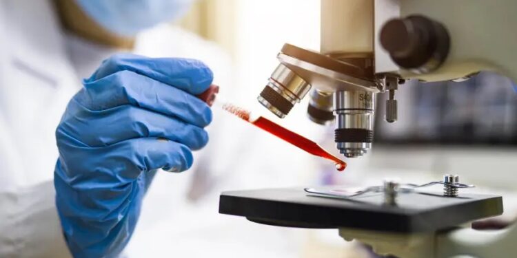 Cientistas brasileiras desenvolvem método que detecta câncer de mama pelo sangue