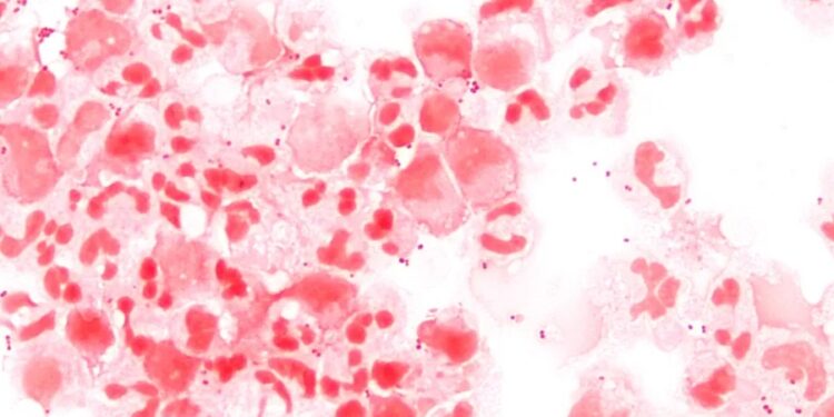 Sergipe já registrou dez mortes por meningite em 2022