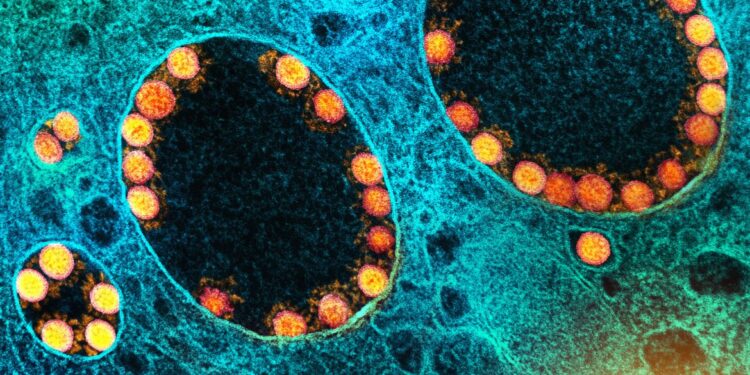 Covid-19: Brasil tem 62 mortes confirmadas nas últimas 24 horas