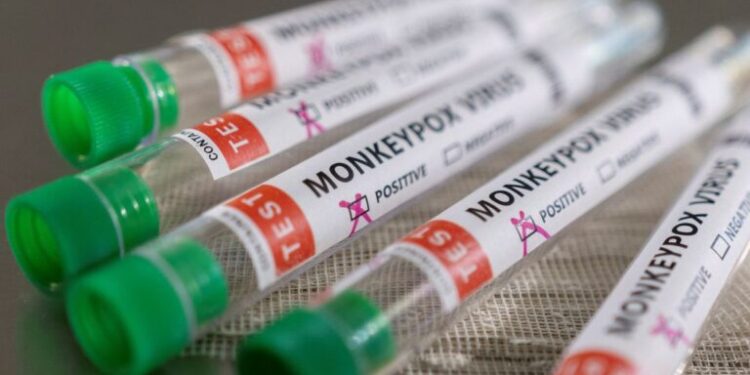 Sergipe registra 15 novos casos de Monkeypox
