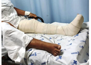 Cresce o número de cirurgias ortopédicas no Hospital de Urgências de Sergipe