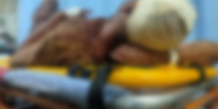 Saúde alerta sobre riscos de trauma na face