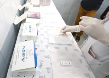 Teste rápido de HIV e outras ISTs será feito em postos de saúde
