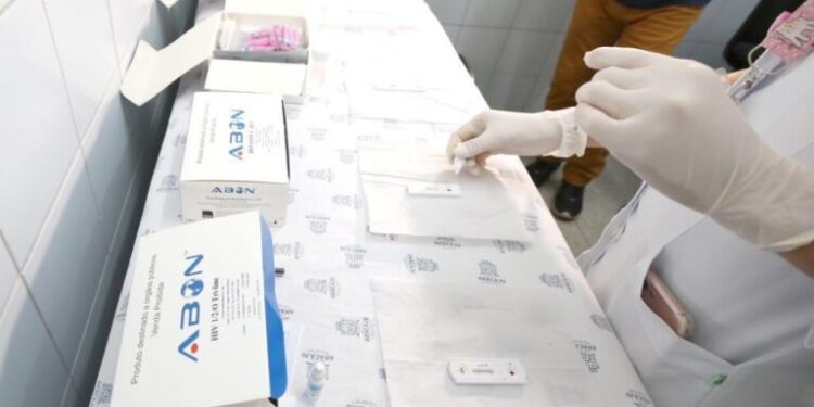 Teste rápido de HIV e outras ISTs será feito em postos de saúde