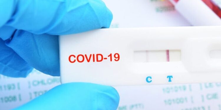 Sergipe registra 06 casos novos de COVID-19 e nenhum óbito nesta segunda-feira