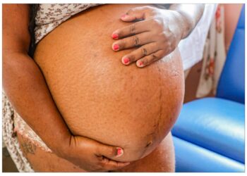 Maternidade Nossa Senhora de Lourdes dá dicas para gestantes que querem curtir o Carnaval