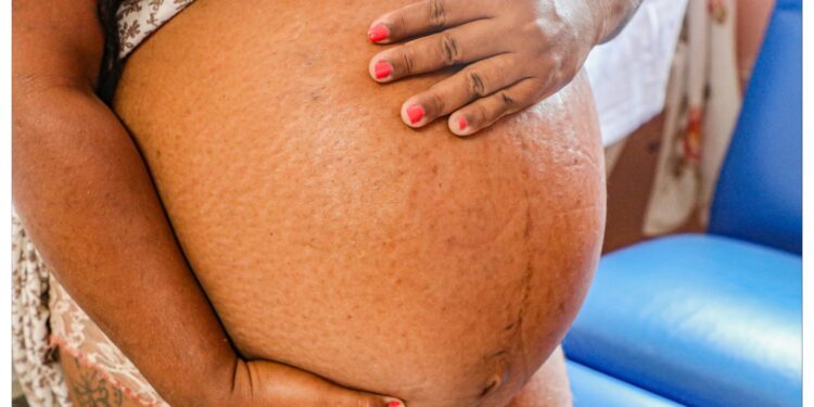 Maternidade Nossa Senhora de Lourdes dá dicas para gestantes que querem curtir o Carnaval