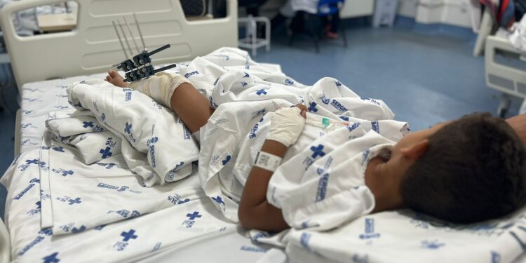 Hospital da Criança registra aumento de 50% nas cirurgias ortopédicas durante férias escolares