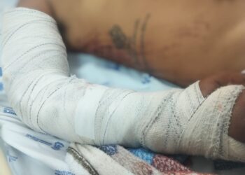 Huse registra aumento de relatório médico para solicitação do seguro DPVAT