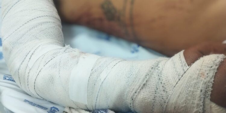 Huse registra aumento de relatório médico para solicitação do seguro DPVAT