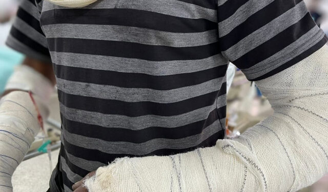 Dados do Huse reforçam a necessidade de campanha de prevenção a acidentes de trânsito